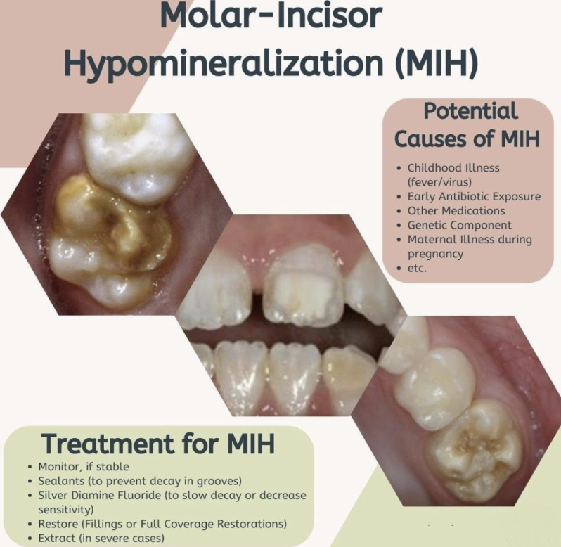 Molar-incisor hypomineralisation overview