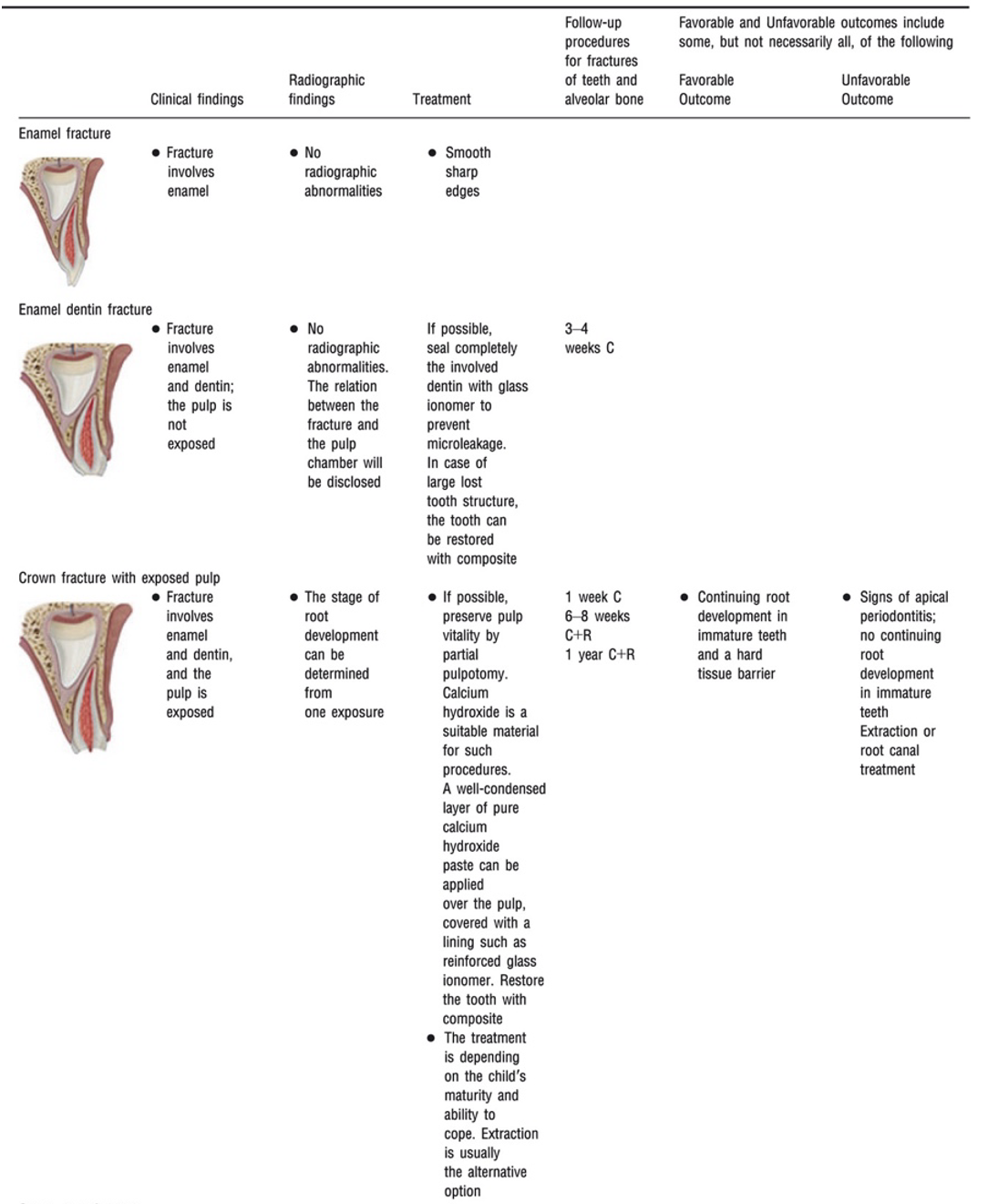 Enamel and crown fracture management table
