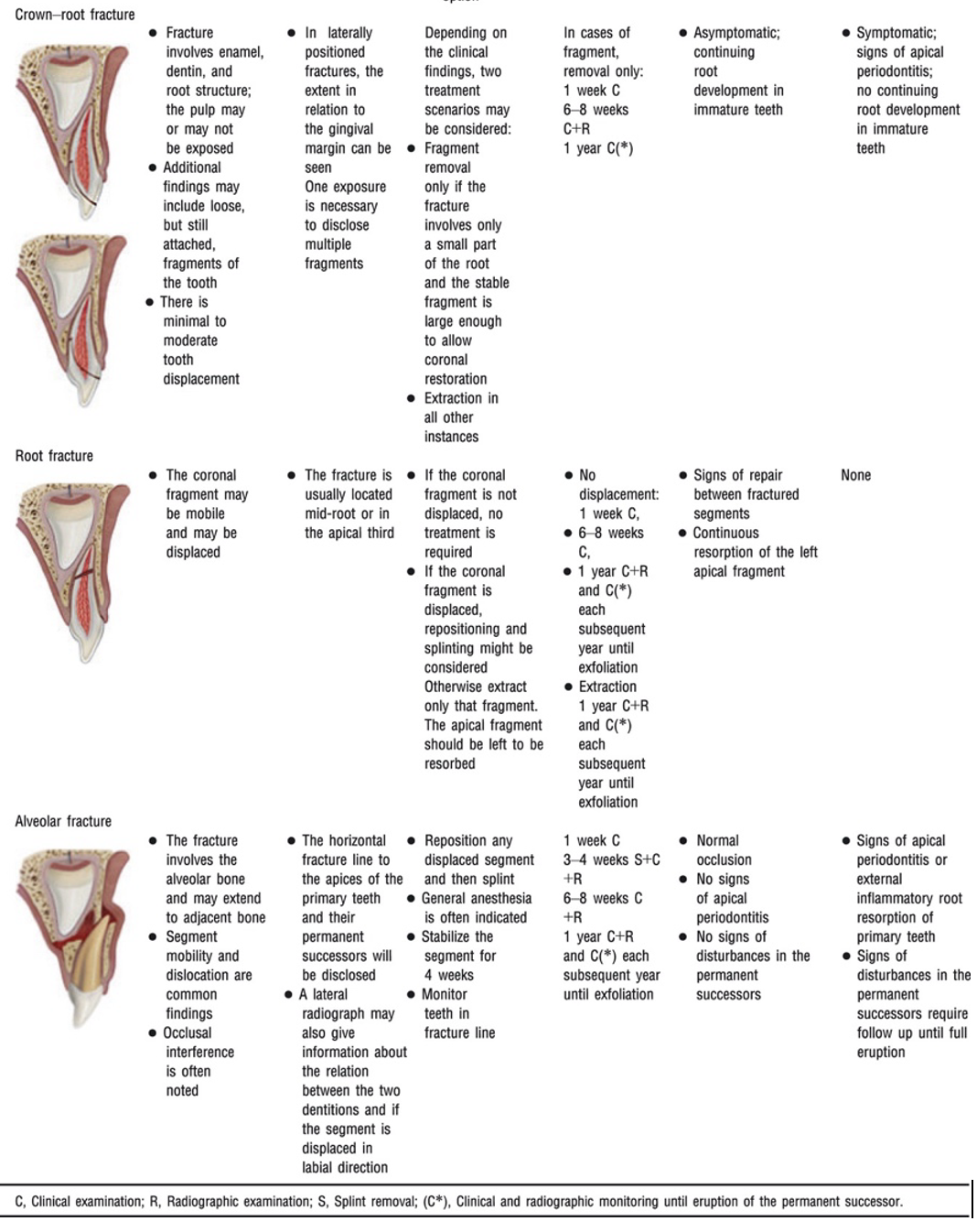 Crown-root, root and alveolar fracture management table