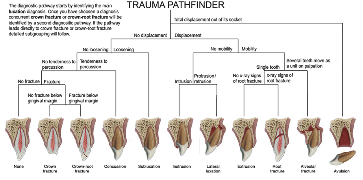 Dental trauma diagnostic pathfinder